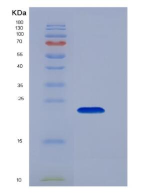 Recombinant Hemoglobin Beta (HBb)