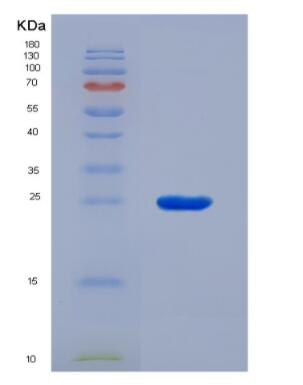Recombinant Matrix Metalloproteinase 9 (MMP9)