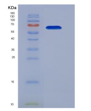 Recombinant Human 5-Hydroxytryptamine Receptor 1A (HTR1A) Protein