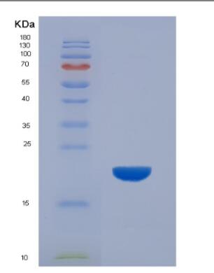Recombinant Human TDP43 peptide