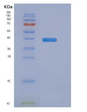 Recombinant Human Syncollin (SYCN) protein
