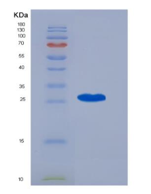 Recombinant Human CENPF protein