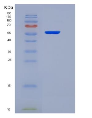Recombinant Thyroid Hormone Receptor Alpha (THRa)