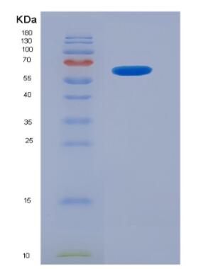 Recombinant Kallikrein 6 (KLK6)