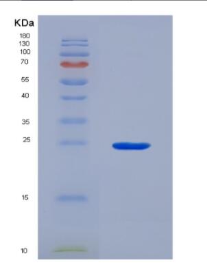 Recombinant Human Glutamate Cysteine Ligase, Catalytic (GCLC)