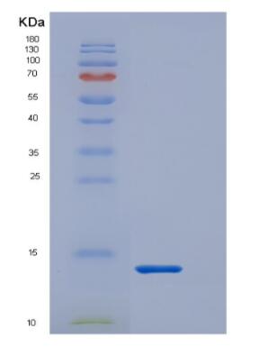 Recombinant S100 Calcium Binding Protein A8 (S100A8)