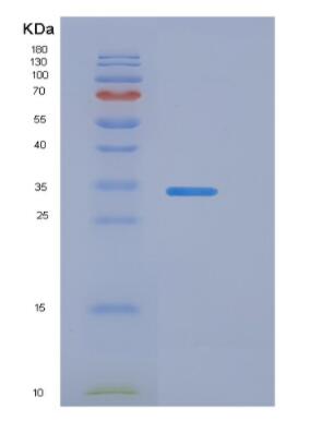 Recombinant Gamma-Glutamyltransferase 1 (gGT1)