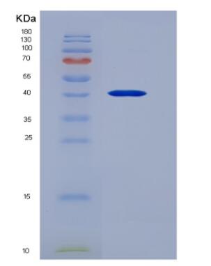 Recombinant Wingless Type MMTV Integration Site Family, Member 5A (WNT5A)