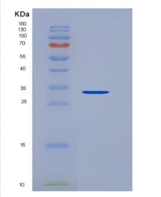 Recombinant Human Plasminogen (Plg) Protein