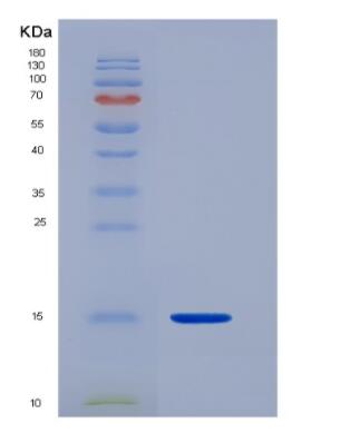 Recombinant Human Calcitonin gene-related peptide 2 Protein