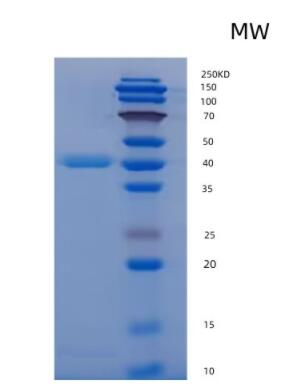 Recombinant human FGL1 protein