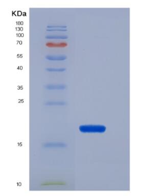 Recombinant Rat POSTN protein