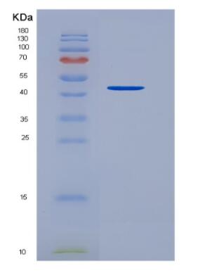 Recombinant Transforming Growth Factor Beta 1 (TGFb1)