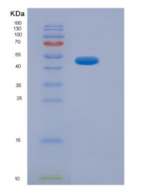 Recombinant Human Nuclear Factor, Erythroid Derived 2 Like Protein 2 (NFE2L2)