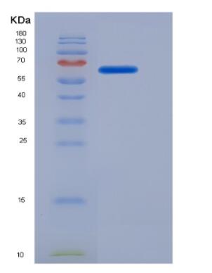Recombinant Monoamine Oxidase A (MAOA)