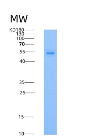 Recombinant Human DOPA Decarboxylase / DDC Protein (His tag)