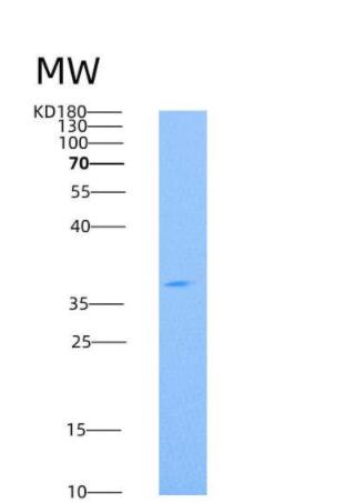 Recombinant Human CD73 / NT5E Protein (His tag)