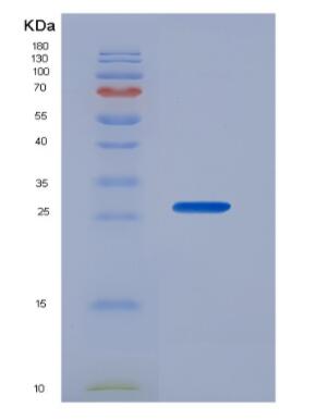 Recombinant Cyclin B (CCNB)