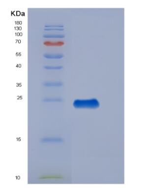 Recombinant Human Thrombomodulin (TM) Protein