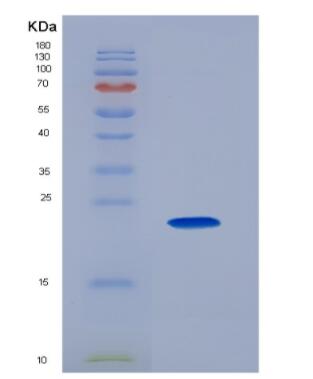 Recombinant Receptor Activator Of Nuclear Factor Kappa B Ligand (RANkL)