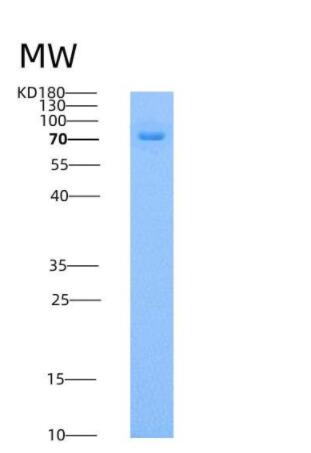 Recombinant Human ILT6 / LILRA3 Protein (Fc tag)