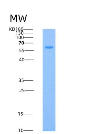 Recombinant Human HPRG / HRG Protein (His tag)
