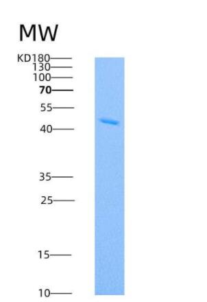 Recombinant Human IDO1 / IDO Protein (His tag)