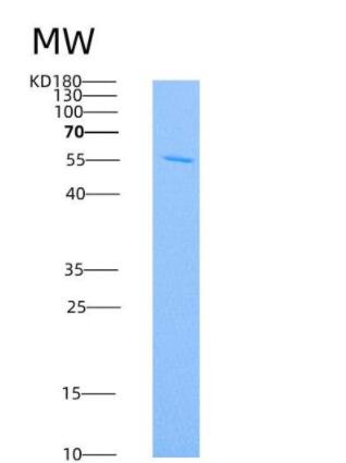 Recombinant Human DCR3 / TNFRSF6B Protein (Fc tag)