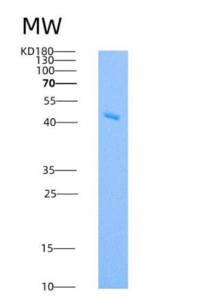 Recombinant Human IDO1 / IDO Protein