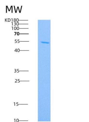 Recombinant Human IL10Rb Protein (His & Fc tag)