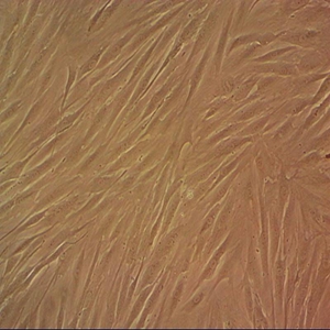 CCC-HPF-1人胚肺成纤维细胞