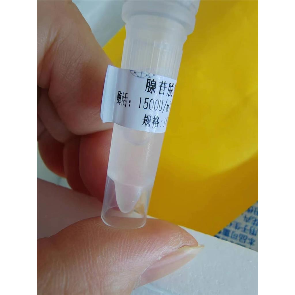 腺苷脱氨酶 (ADA) 液体  冻干粉