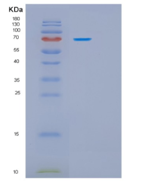 Recombinant Human HSPA9 Protein