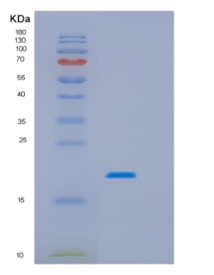 Recombinant Human HSPB3 Protein