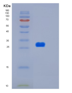 Recombinant Human HTATIP2 Protein