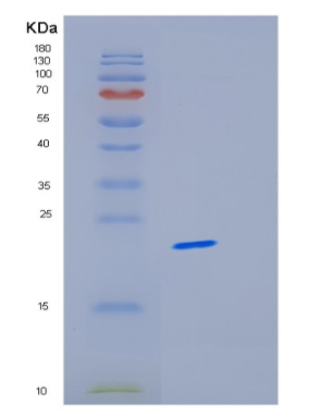 Recombinant Human ICT1 Protein