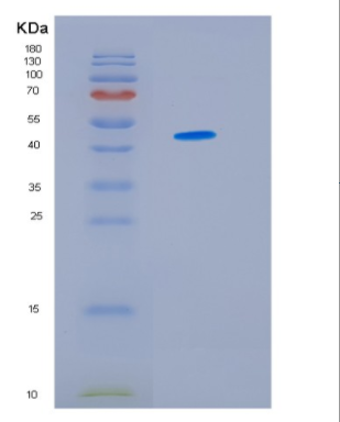 Recombinant Human IDH1 Protein