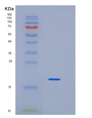 Recombinant Human ID1 Protein