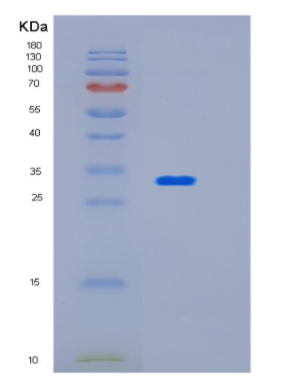Recombinant Human HUS1 Protein