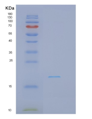 Recombinant Interferon Gamma (IFNg)