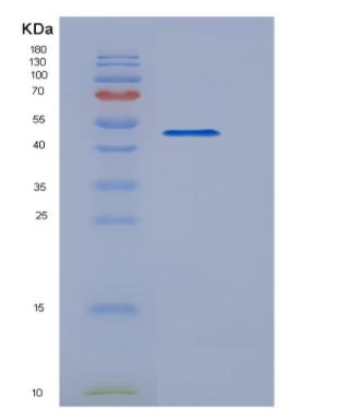 Recombinant Human IFNL2 Protein
