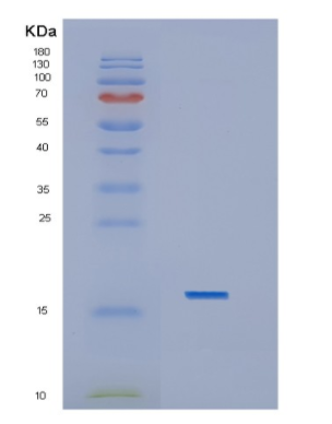 Recombinant Interleukin 1 Beta (IL1b)