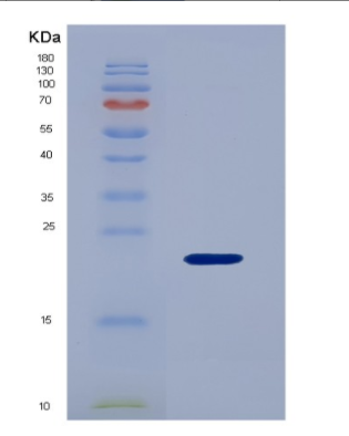 Recombinant Human IGFBP3 Protein