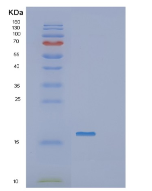 Recombinant Human IGJ Protein