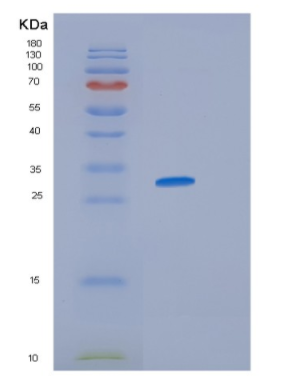 Recombinant Human IDI1 Protein
