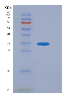 Recombinant Insulin Like Growth Factor Binding Protein 7 (IGFBP7)