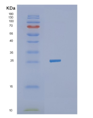 Recombinant Human IGFBP6 Protein