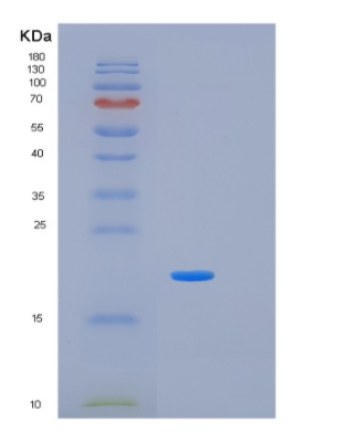 Recombinant Human IL17B Protein