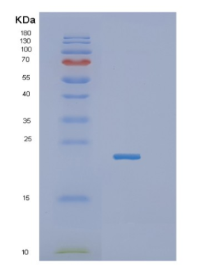 Recombinant Human IGLL1 Protein