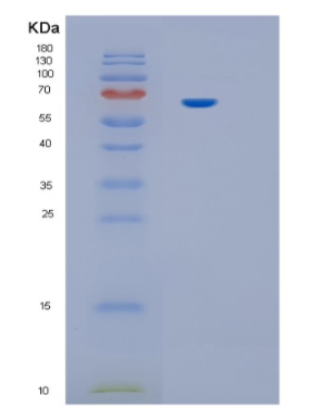 Recombinant Human IL12RB1 Protein